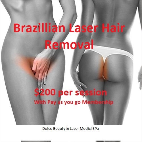 Laser Hair Removal Dolce Beauty And Laser Medical Spa by